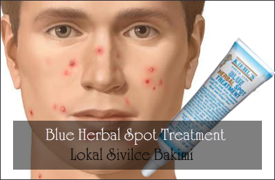 blue-herbal-spot-treatment flatcast tema